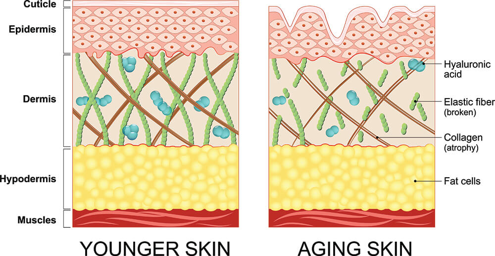 Collagen and elastin in young vs. aging skin