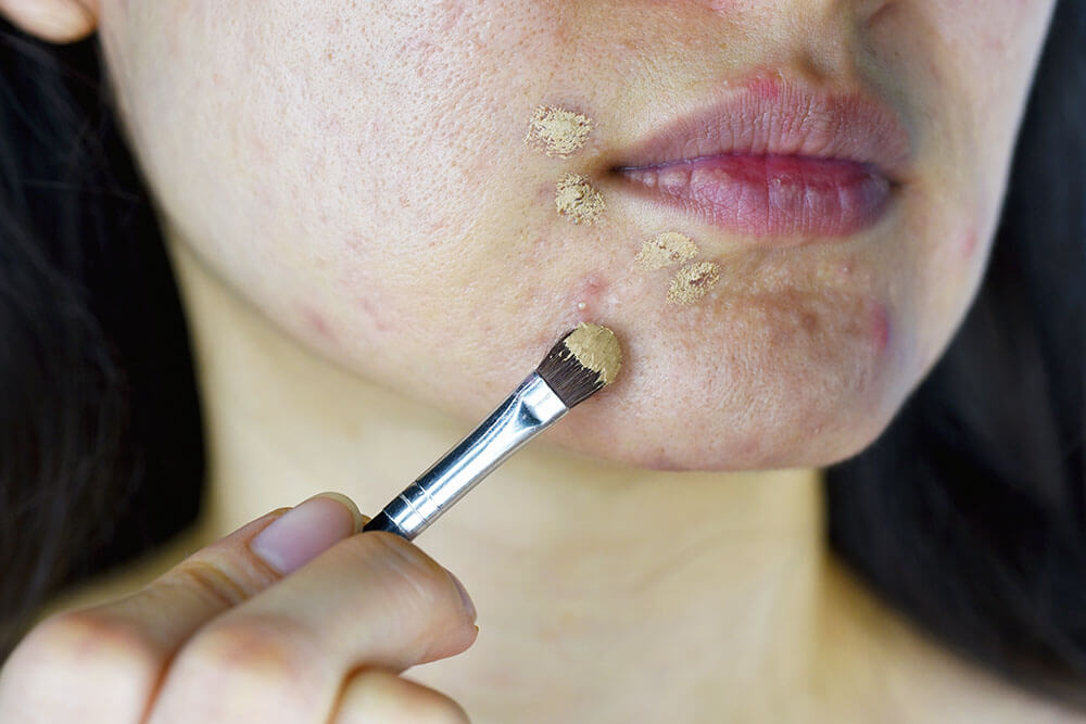 A woman covering up a pimple with concealer makeup