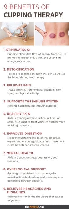 Image result for benefits of cupping therapy