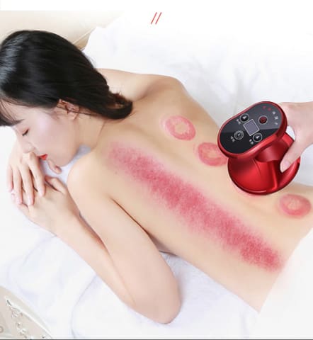 Electric Rechargeable Cupping Massager