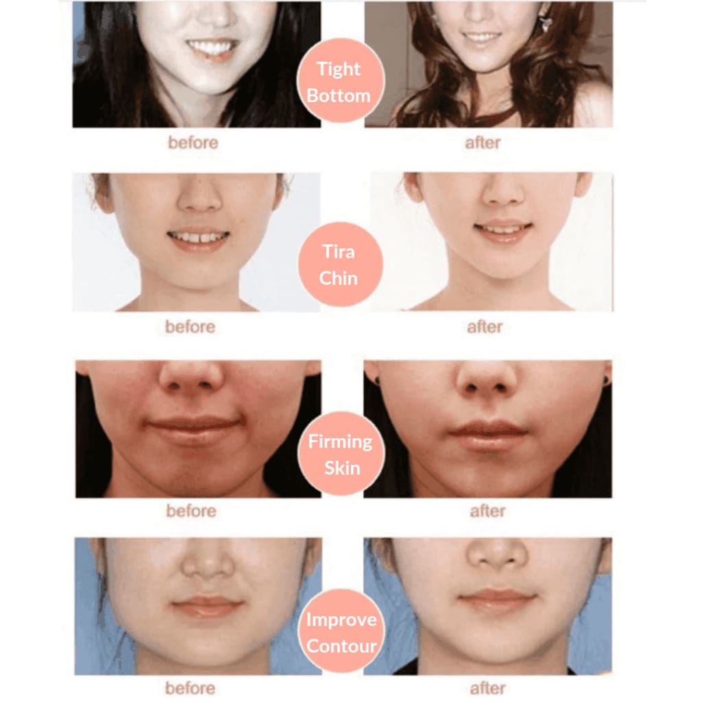 V Shape Lifting Facial Mask Face Slim