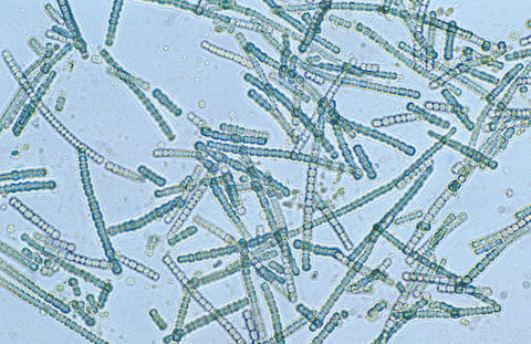 Cyanobacteria under a microscope