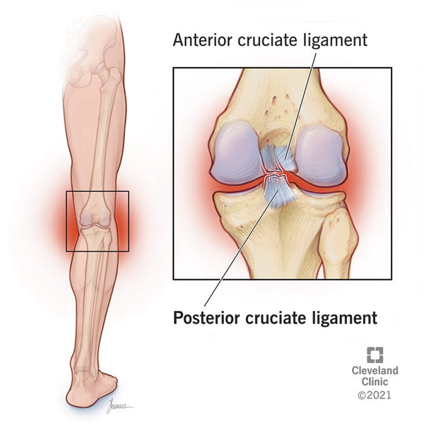 ACL and PCL injuries