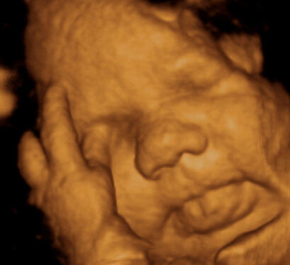 38 haftalık bebek ultrason