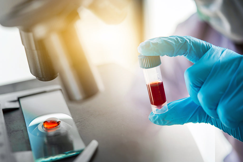 blood test - tube of blood sample - lab results