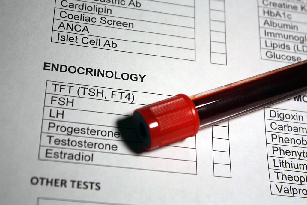 blood sample - hormone panel - lab results