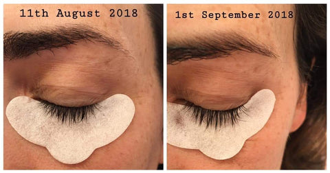 eyelash treatment