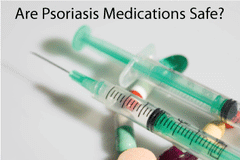 Psoriasis Treatments