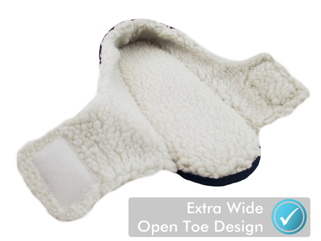 edema slippers