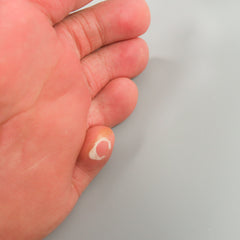 ซิลิโคนคั่นนิ้ว แบบรองหน้าเท้า - Gel Toe Separators Bunion Relief Forefoot Cushioning
