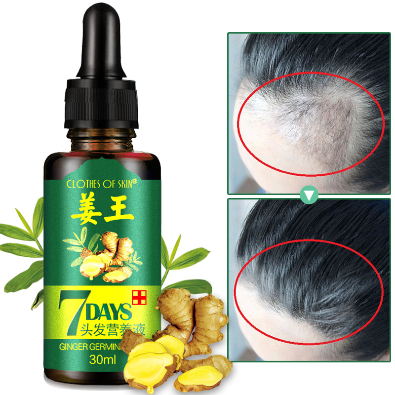 

Ulei esențial împotriva căderii părului, regenerant, 30 ml