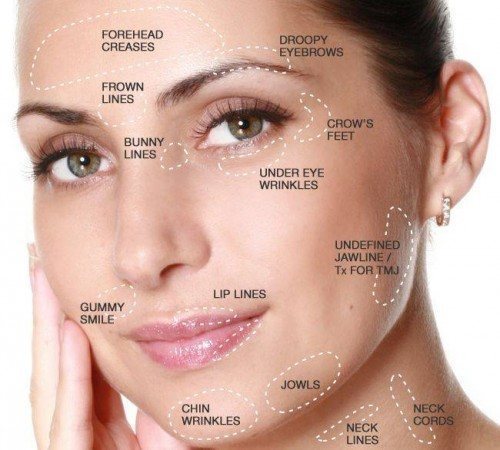 Anti Wrinkle 3 Areas Facethetics