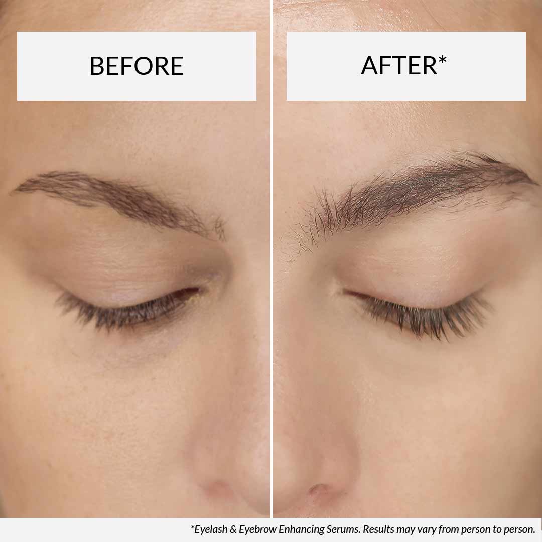 Hairlust eyelash serum before after