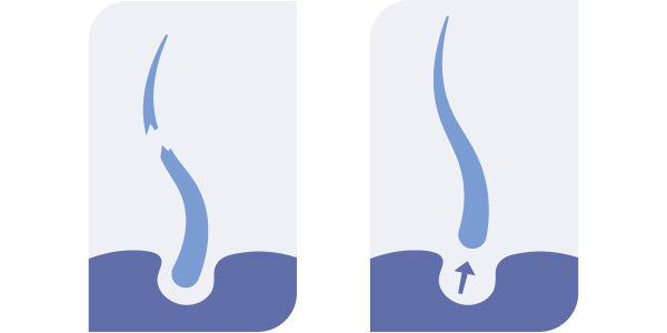 Gebroken haar versus Shedding