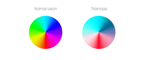 Tritanopia vision, color blindness infographic. Human vision deficiency concept.