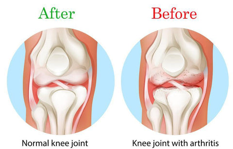 Nylon Silicon Knee Protection