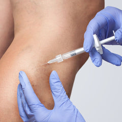 Sclerotherapy on leg