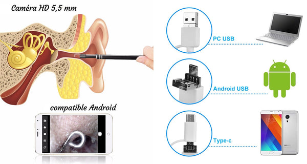 compatibilité de la caméra endoscopique pour nettoyer ses oreilles