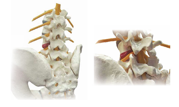 lumbar facet joints