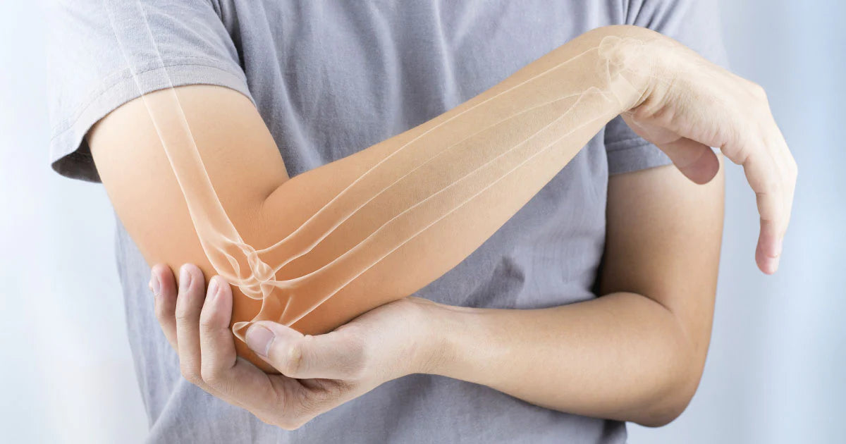 How to Fix Arm Muscle Pain in 30 SECONDS 