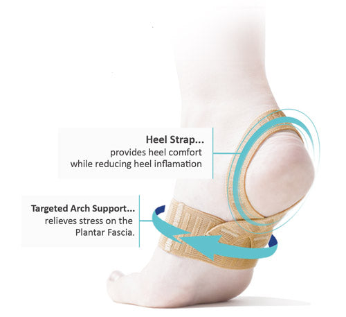 THE X BRACE DIFFERENCE