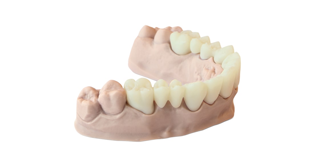 BURN2 - Dental Casting Resin