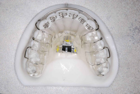 Day and night appliance (or DNA appliance)