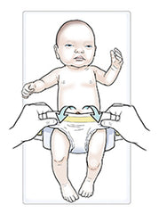 nappy changing with umbilical cord stump