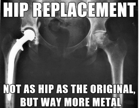 hip replacement meme jacked on the beanstalk vegan podcast sarah shorkey