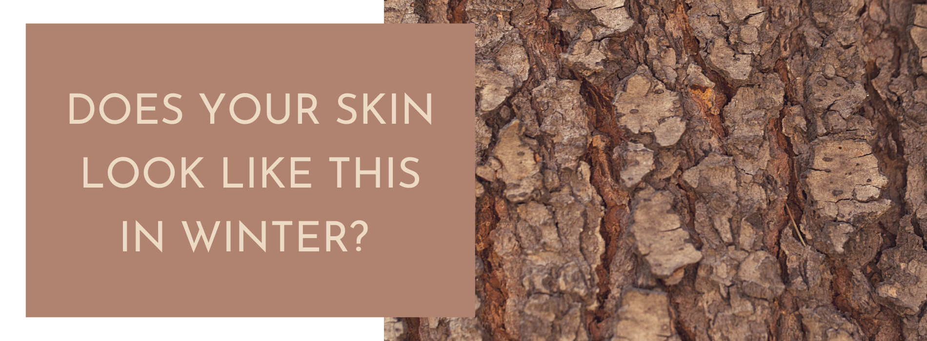 Does your skin look like this in winter?