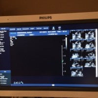 Our first ultrasound