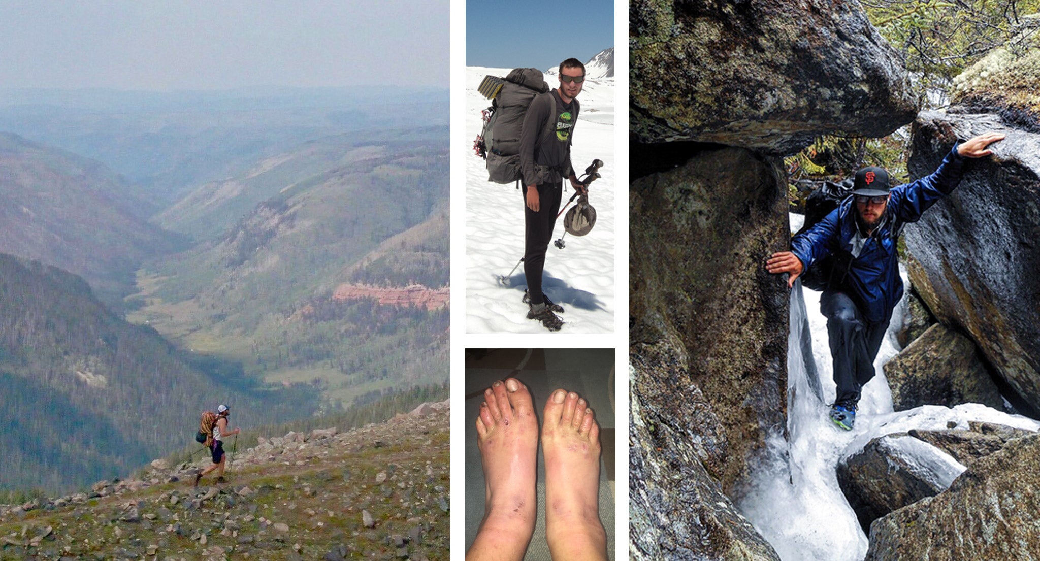 Compilation of hiking images and swollen feet