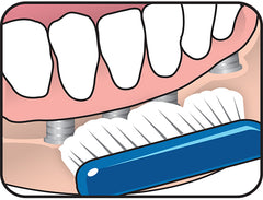 Cepillo Implant Ortho para implantes