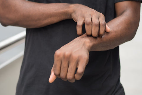 Man who has excoriation, scratching his arm.