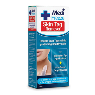 compound w freeze off skin tag remover