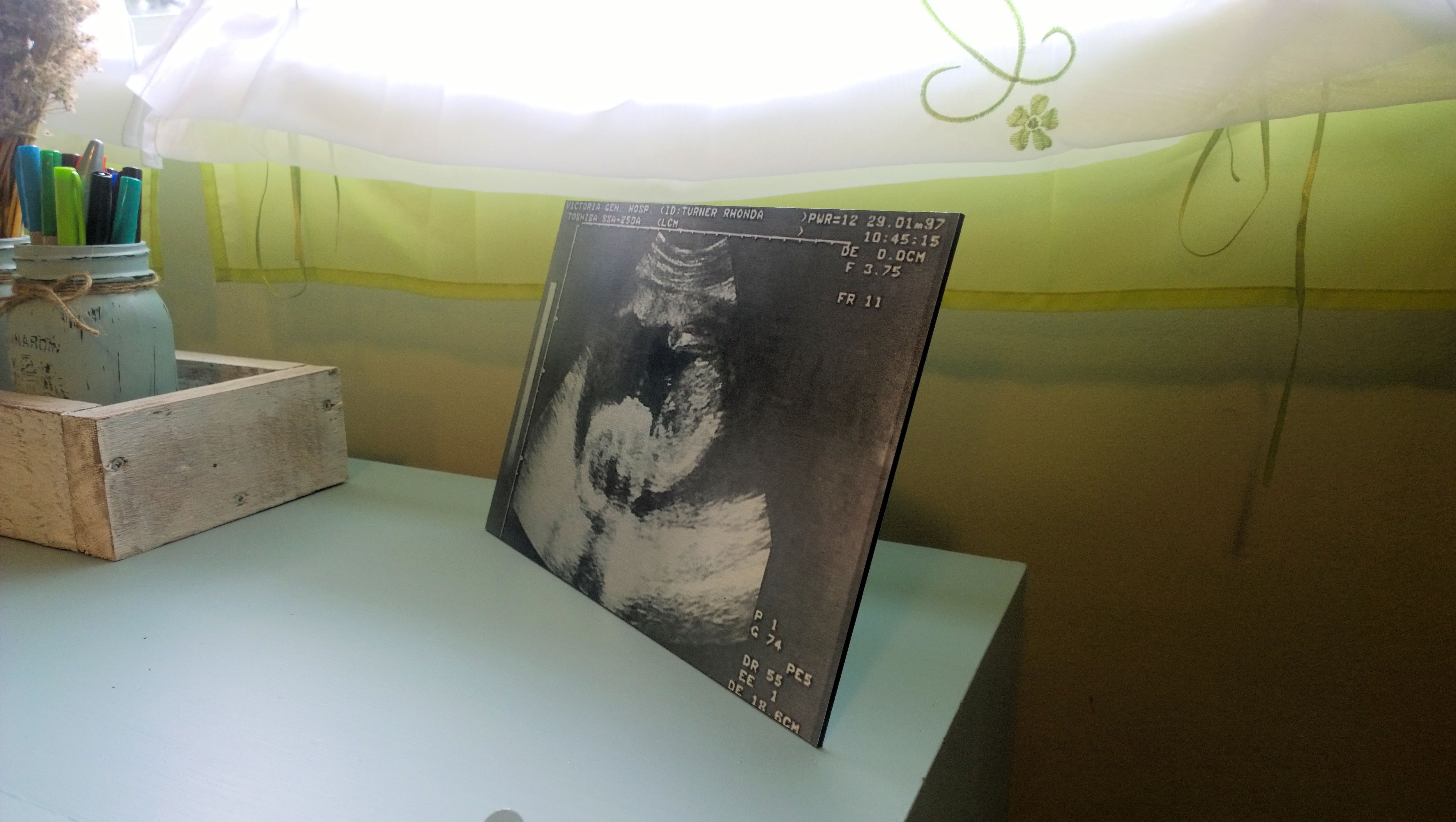 Room makeover project - preserving an ultrasound image by printing it on a Posterjack Metal Print