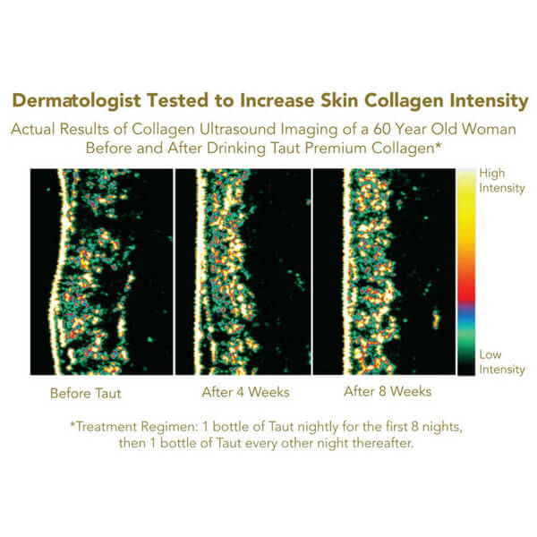 Skin Collagen density increase after drinking Taut Collagen