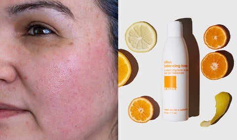 Left: Close up of woman's cheek. Right: White bottle surround by slices of oranges and lemons.