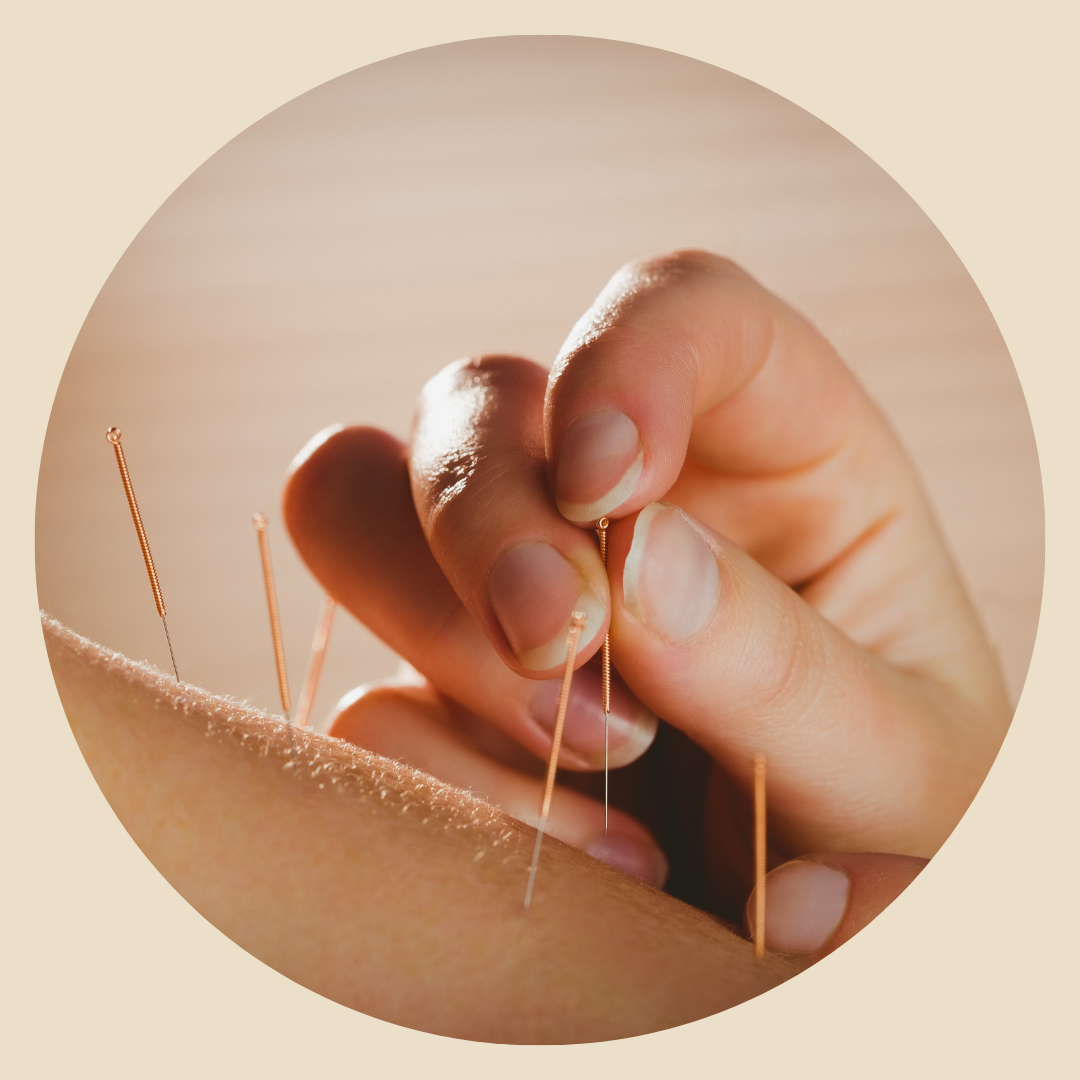 Acupuncture For Pain