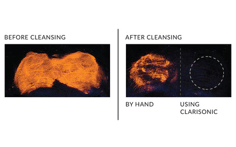 Before and after results from cleaning face with Clarisonic sonic brush versus manual cleansing