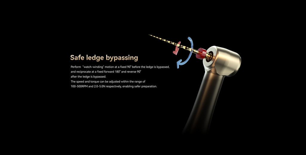 Woodpecker AiMotor by 𝐛𝐲 𝐘𝐨𝐬𝐡𝐢 𝐓𝐞𝐫𝐚𝐮𝐜𝐡𝐢