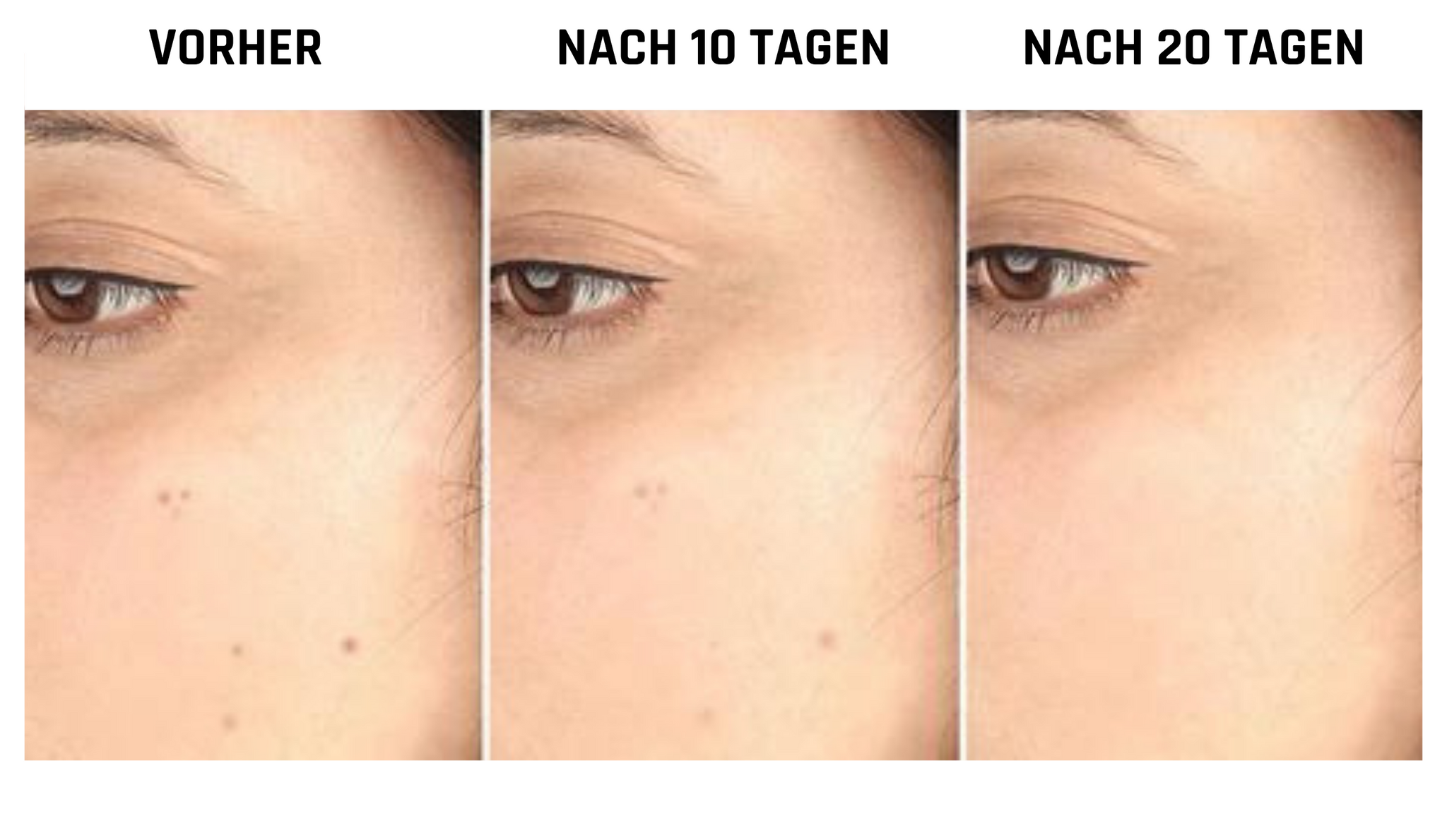 Naturliches Reinigungsol By Skincare Best Trends De